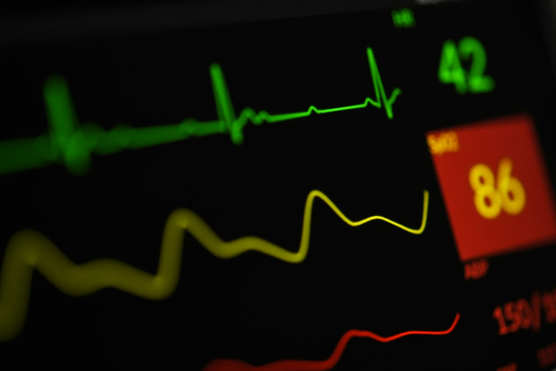 Écran de surveillance du rythme cardiaque
