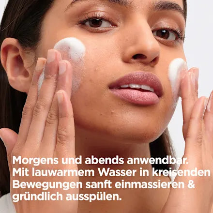 Mixa Gel Nettoyant Anti-Imperfections – Mubina Essence