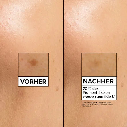 GARNIER GLOW BOOSTER  Sérum Vitamine C Anti-Taches • Qualité Allemagne 🇩🇪